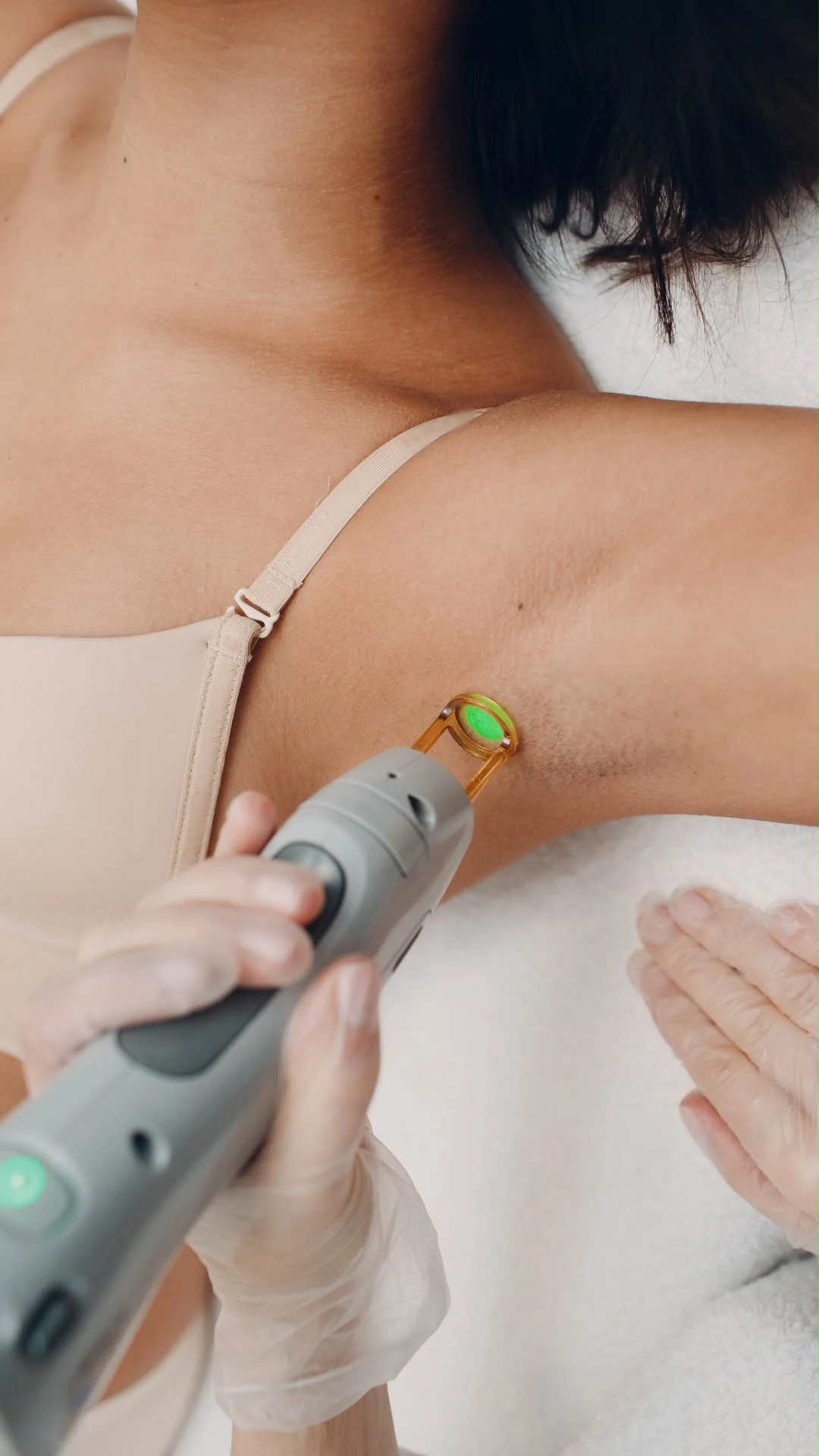 Laserbehandeling van een oksel